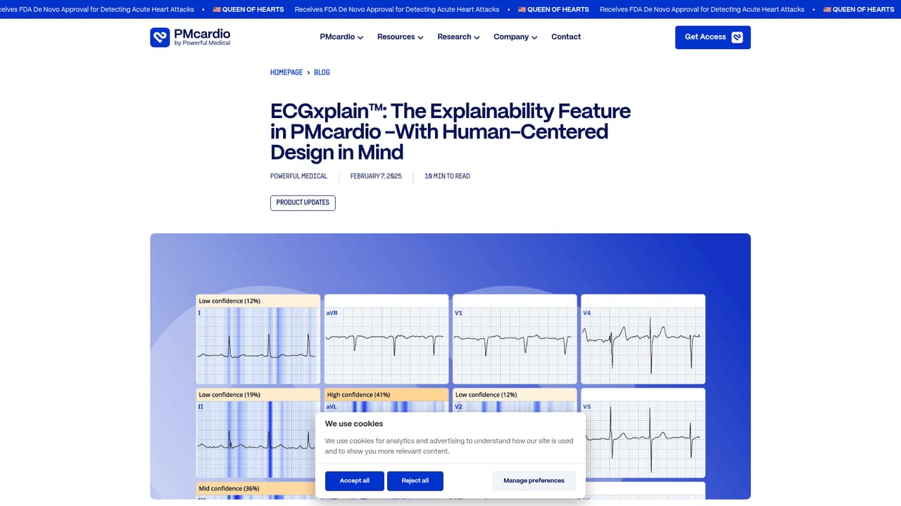 PMcardio — Review the ECGxplain heatmaps