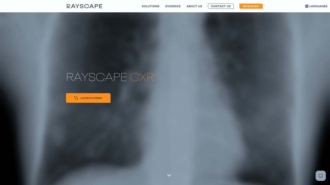Rayscape — Review the chest X-ray product scope